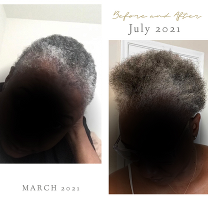 Moisture Seal Set-Ultimate Hydration and Protection for Dry, Brittle Hair